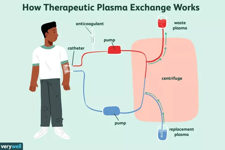 plasmapheresis-treatment-in-aurangabad