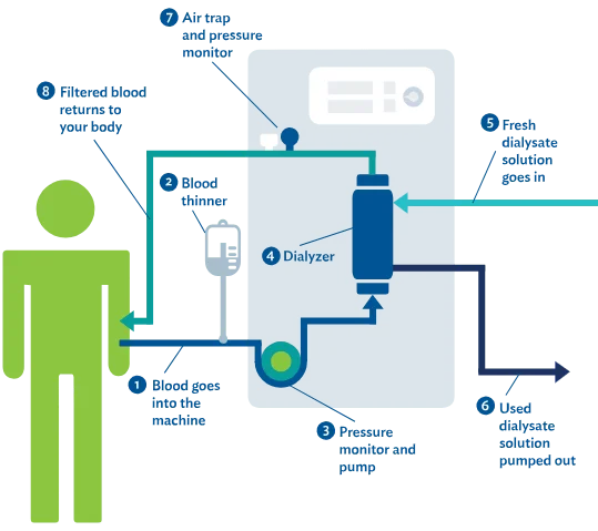 Acute Hemodialysis in Aurangabad